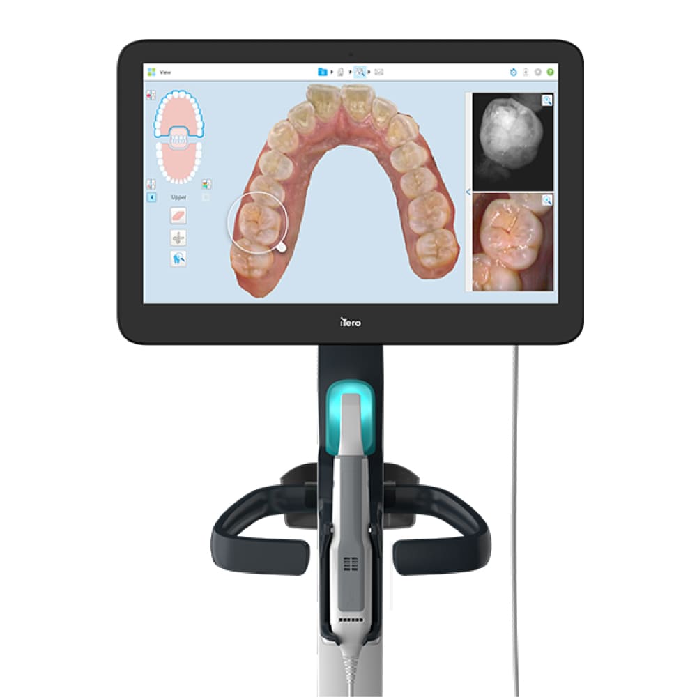 Intraoralscanner